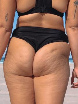 OnlyFans - BIKINI GIRLS 👧 😍 Scene 7982 — photo 1 of 20